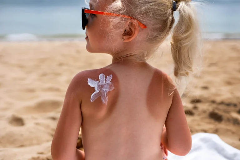 1-view-young-girl-beach-with-lotion-sunburn-skin