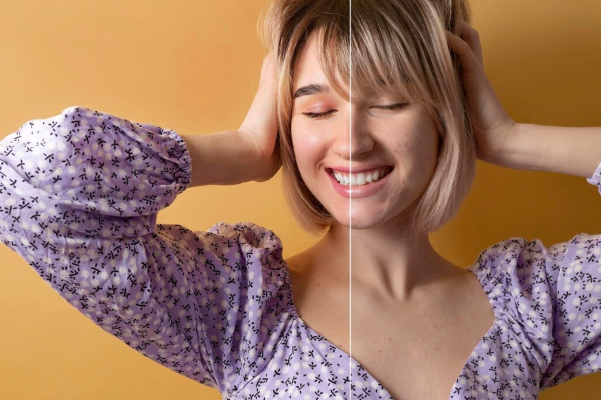 titanium dioxide particles